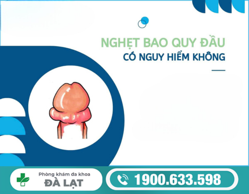 Hình ảnh minh họa